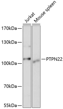 Western blot - PTPN22 Polyclonal Antibody 