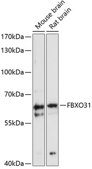 Western blot - FBXO31 Polyclonal Antibody 