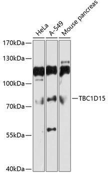 Western blot - TBC1D15 Polyclonal Antibody 