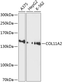 Western blot - COL11A2 Polyclonal Antibody 