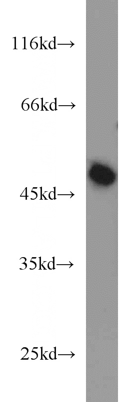 mouse kidney tissue were subjected to SDS PAGE followed by western blot with Catalog No:108299(ATG5 antibody) at dilution of 1:1000