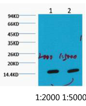 Western blot analysis of Hela, diluted at 1) 1:2000 2) 1:5000