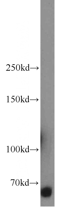K-562 cells were subjected to SDS PAGE followed by western blot with Catalog No:110400(ERAP2 antibody) at dilution of 1:600