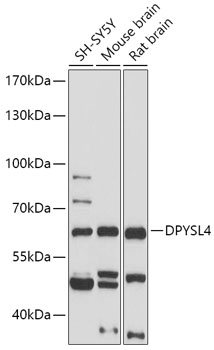 Western blot - DPYSL4 Polyclonal Antibody 