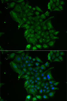 Immunofluorescence - TCN1 Polyclonal Antibody 