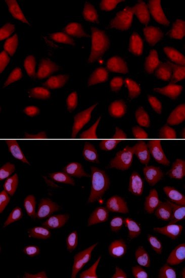 Immunofluorescence - DLGAP5 Polyclonal Antibody 