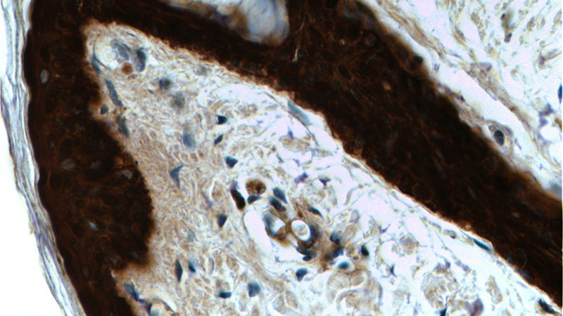 Immunohistochemistry of paraffin-embedded human skin tissue slide using Catalog No:107551(SFN Antibody) at dilution of 1:2000 (under 40x lens).