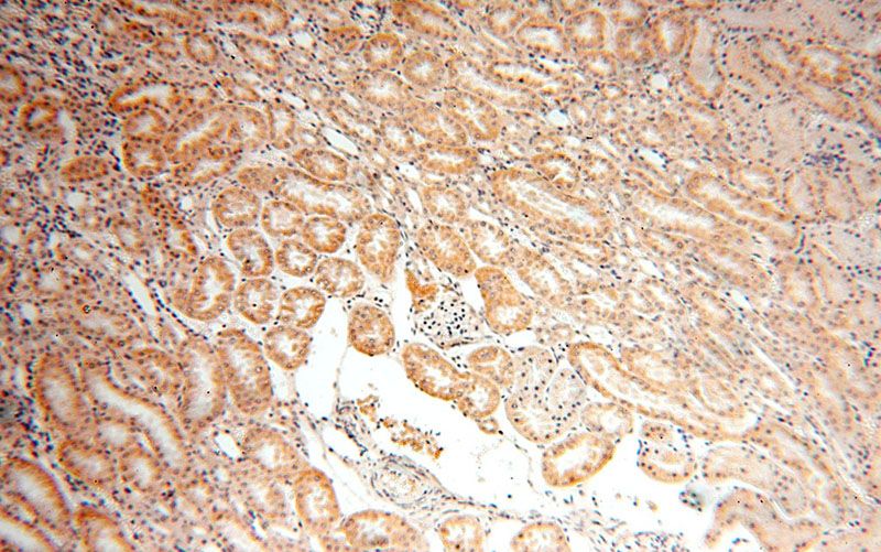 Immunohistochemical of paraffin-embedded human kidney using Catalog No:115160(SFXN2 antibody) at dilution of 1:100 (under 10x lens)