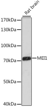 Western blot - MEI1 Polyclonal Antibody 