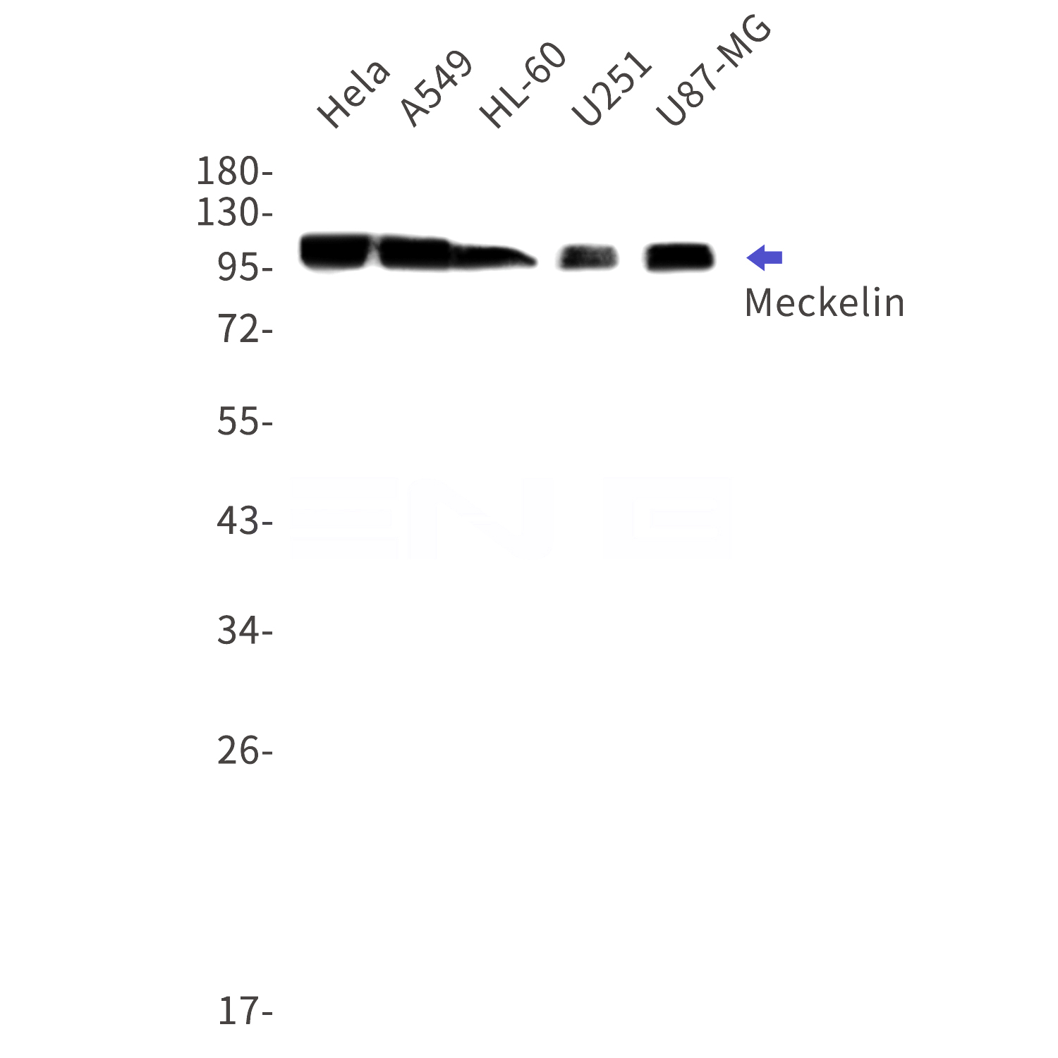 Western blot detection of Meckelin in Hela,A549,HL-60,U251,U87-MG cell lysates using Meckelin Rabbit mAb(1:1000 diluted).Predicted band size:112kDa.Observed band size:112kDa.