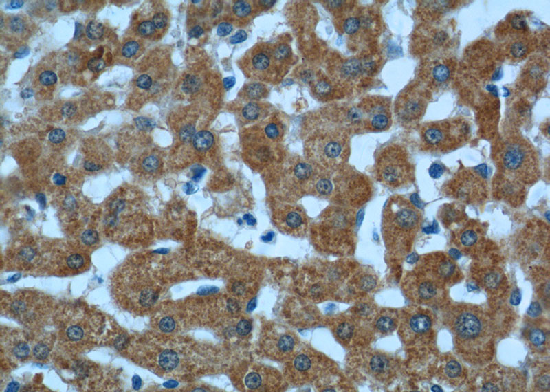 Immunohistochemistry of paraffin-embedded human liver tissue slide using Catalog No:107972(ALDH5A1 Antibody) at dilution of 1:50 (under 40x lens)
