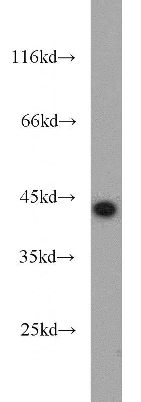 HeLa cells were subjected to SDS PAGE followed by western blot with Catalog No:115926(TARDBP antibody) at dilution of 1:1000