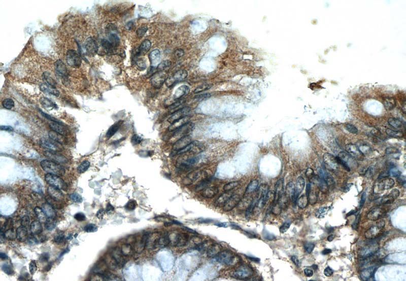 Immunohistochemistry of paraffin-embedded human colon tissue slide using Catalog No:108635(C10orf68 Antibody) at dilution of 1:50 (under 40x lens)