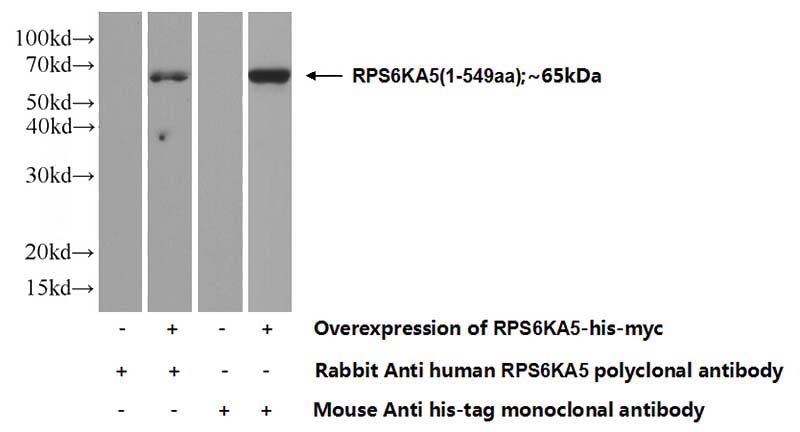 Transfected HEK-293 cells were subjected to SDS PAGE followed by western blot with Catalog No:112871(RPS6KA5 Antibody) at dilution of 1:500