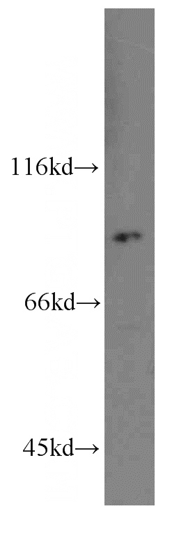 A549 cells were subjected to SDS PAGE followed by western blot with Catalog No:114924(RRM1-Specific antibody) at dilution of 1:100