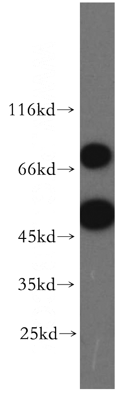 Jurkat cells were subjected to SDS PAGE followed by western blot with Catalog No:114622(REXO4,REX4 antibody) at dilution of 1:1000