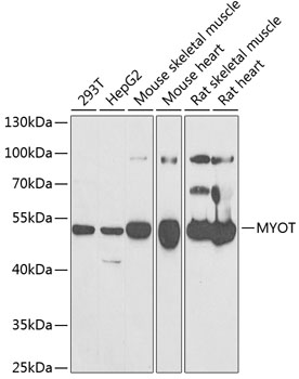 Western blot - MYOT Polyclonal Antibody 