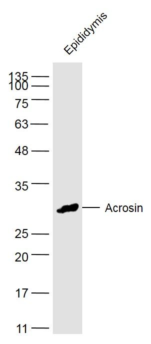 Fig4: Sample:; Epididymis (Mouse) Lysate at 40 ug; Primary: Anti-Acrosin at 1/300 dilution; Secondary: IRDye800CW Goat Anti-Rabbit IgG at 1/20000 dilution; Predicted band size: 33/44kD; Observed band size: 33 kD