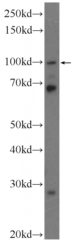 HeLa cells were subjected to SDS PAGE followed by western blot with Catalog No:111516(RNF31 Antibody) at dilution of 1:100