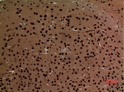 Fig2:; Immunohistochemical analysis of paraffin-embedded mouse-brain, antibody was diluted at 1:100