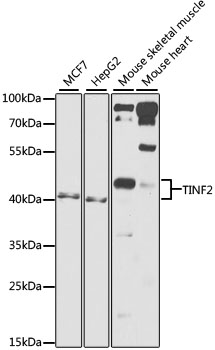 Western blot - TINF2 Polyclonal Antibody 