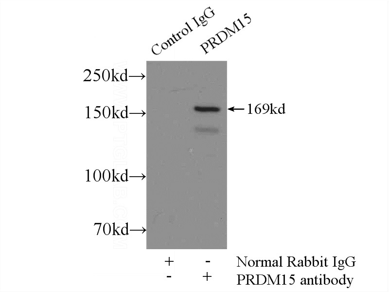 IP Result of anti-PRDM15 (IP:Catalog No:114173, 5ug; Detection:Catalog No:114173 1:500) with MCF-7 cells lysate 2500ug.