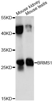 Western blot - BRMS1 Polyclonal Antibody 