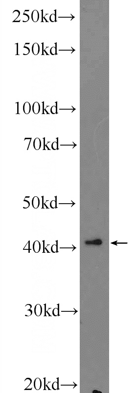 HepG2 cells were subjected to SDS PAGE followed by western blot with Catalog No:114758(RNF38 Antibody) at dilution of 1:300