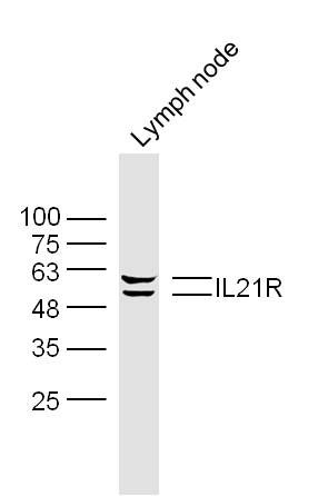 Fig1: Sample:; Lymph node (Mouse) Lysate at 40 ug; Primary: Anti- IL21R at 1/300 dilution; Secondary: IRDye800CW Goat Anti-Rabbit IgG at 1/20000 dilution; Predicted band size: 55 kD; Observed band size: 55 kD