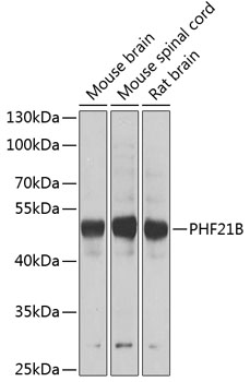 Western blot - PHF21B Polyclonal Antibody 