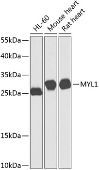 Western blot - MYL1 Polyclonal Antibody 