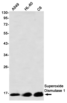 Western blot detection of Superoxide Dismutase 1 in A549,HL-60,C6 using Superoxide Dismutase 1 Rabbit mAb(1:1000 diluted)