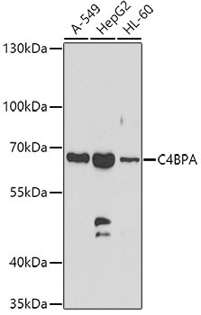 Western blot - C4BPA Polyclonal Antibody 