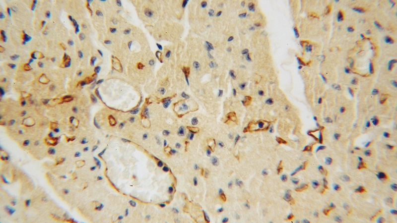 Immunohistochemical of paraffin-embedded human heart using Catalog No:116054(THBD antibody) at dilution of 1:50 (under 40x lens)