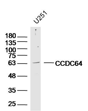 Fig1: Sample: U251(human) Cell Lysate at 40 ug; Primary: Anti-CCDC64 at 1/300 dilution; Secondary: IRDye800CW Goat Anti-Rabbit IgG at 1/20000 dilution; Predicted band size: 65 kD; Observed band size: 63 kD