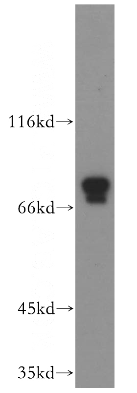 K-562 cells were subjected to SDS PAGE followed by western blot with Catalog No:113929(PLAA antibody) at dilution of 1:500