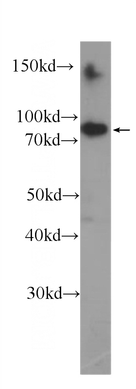 Y79 cells were subjected to SDS PAGE followed by western blot with Catalog No:107268(HSP90 Antibody) at dilution of 1:4000