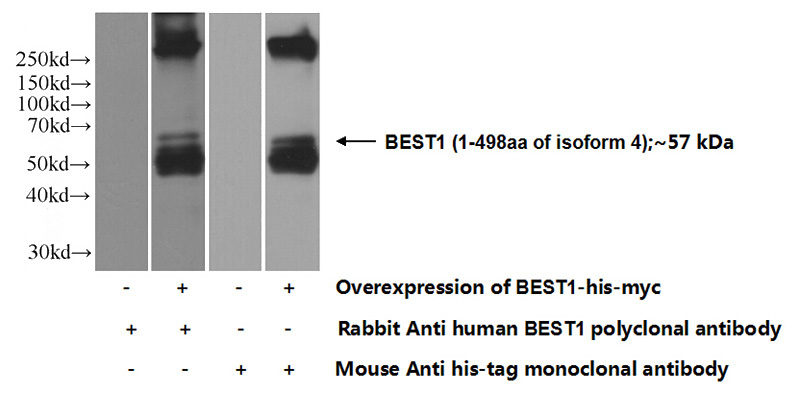 Transfected HEK-293 cells were subjected to SDS PAGE followed by western blot with Catalog No:117119(BEST1 Antibody) at dilution of 1:700