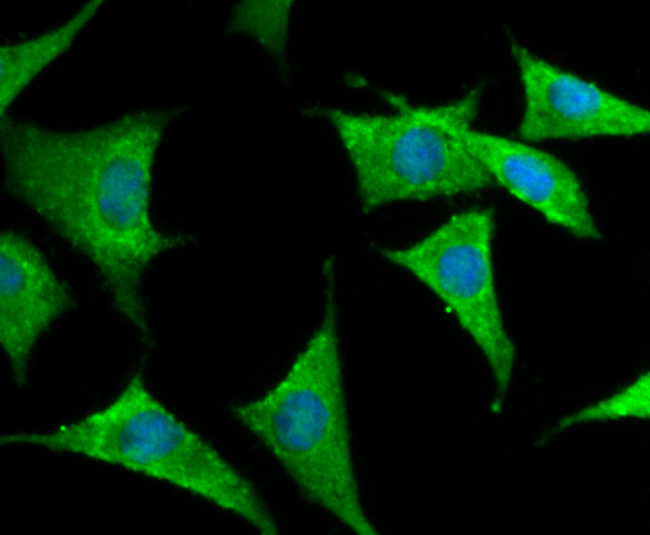 Fig3: ICC staining Kv1.4 in SH-SY5Y cells (green). The nuclear counter stain is DAPI (blue). Cells were fixed in paraformaldehyde, permeabilised with 0.25% Triton X100/PBS.