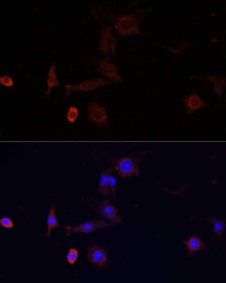 Immunofluorescence - WDR81 Polyclonal Antibody 