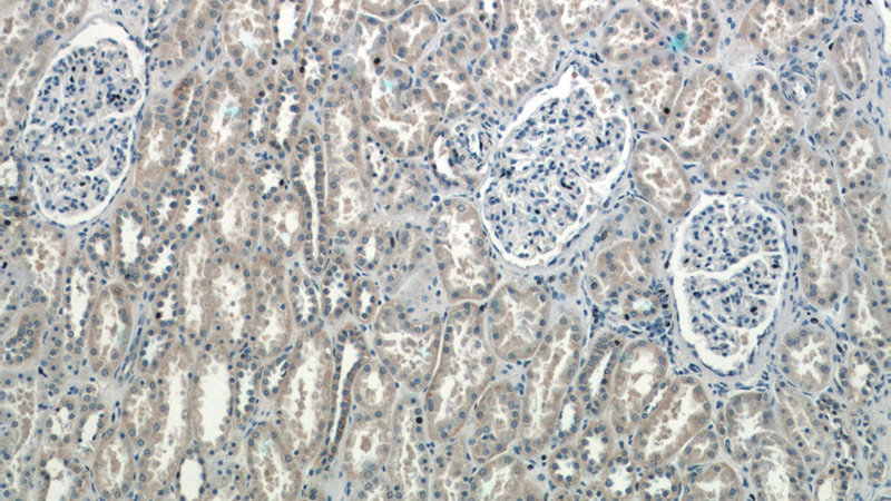 Immunohistochemistry of paraffin-embedded human kidney tissue slide using Catalog No:115578(SPocK1 Antibody) at dilution of 1:50 (under 10x lens)