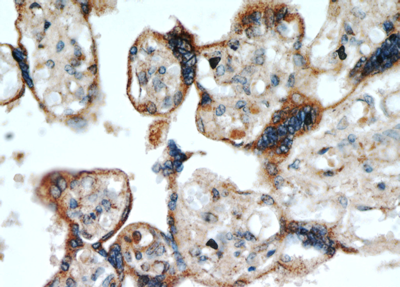 Immunohistochemical of paraffin-embedded human placenta using Catalog No:116081(TMC1 antibody) at dilution of 1:100 (under 40x lens)