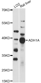 Western blot - ADH1A Polyclonal Antibody 
