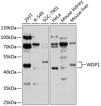 Western blot - WISP1 Polyclonal Antibody 