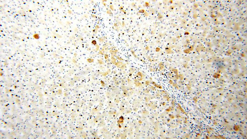 Immunohistochemical of paraffin-embedded human liver using Catalog No:116396(TRMT11 antibody) at dilution of 1:50 (under 10x lens)