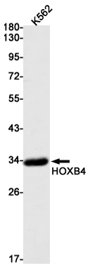 Western blot detection of HOXB4 in K562 cell lysates using HOXB4 Rabbit mAb(1:1000 diluted).Predicted band size:28kDa.Observed band size:34kDa.