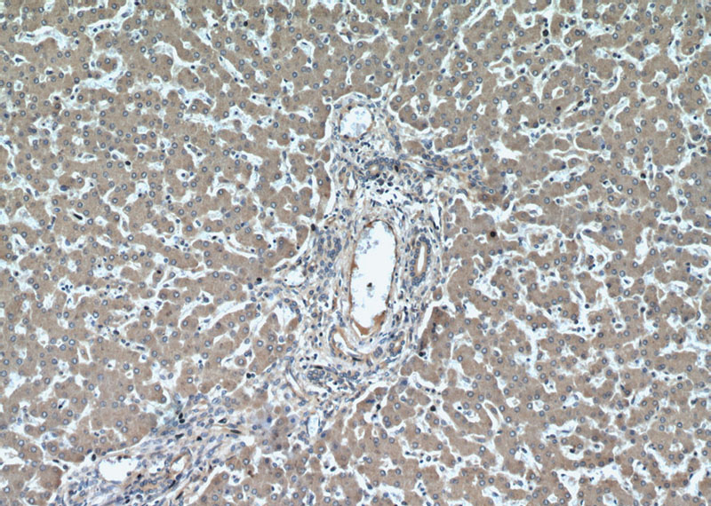 Immunohistochemical of paraffin-embedded human liver using Catalog No:108534(BST2 antibody) at dilution of 1:50 (under 10x lens)