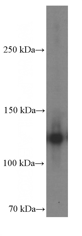 A431 cells were subjected to SDS PAGE followed by western blot with Catalog No:107456(CDH3 Antibody) at dilution of 1:1000