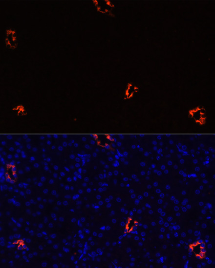 Immunofluorescence - AQP2 Polyclonal Antibody 