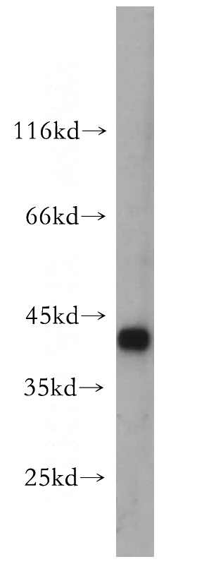 HeLa cells were subjected to SDS PAGE followed by western blot with Catalog No:111473(HMBS antibody) at dilution of 1:300